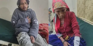 चमोली में भालू का हमला, एक ही परिवार के चार लोग घायल; हायर सेंटर रेफर